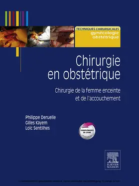 Sentilhes / Deruelle / Kayem |  Chirurgie en obstétrique | eBook | Sack Fachmedien