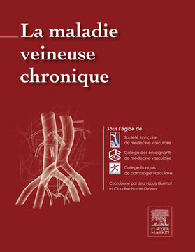 Guilmot / ROBIN-PREVALLEE |  La maladie veineuse chronique | eBook | Sack Fachmedien