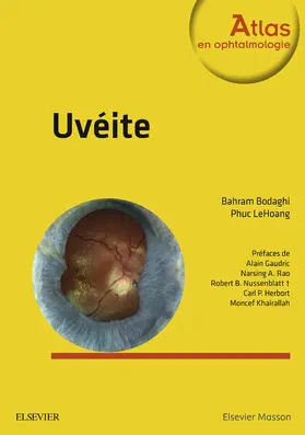 Bodaghi / LeHoang |  Uvéite | eBook | Sack Fachmedien