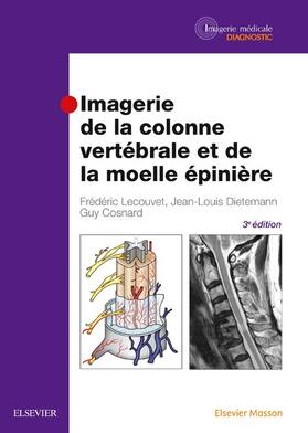 Cosnard / Dietemann / Lecouvet |  Imagerie de la colonne vertébrale et de la moelle épinière | eBook | Sack Fachmedien