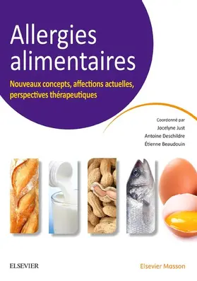 Just / Beaudouin / Deschildre |  Allergies alimentaires | eBook | Sack Fachmedien