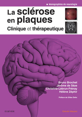 Brochet / Lebrun-Frenay / Zéphir |  La sclérose en plaques - Clinique et thérapeutique | eBook | Sack Fachmedien