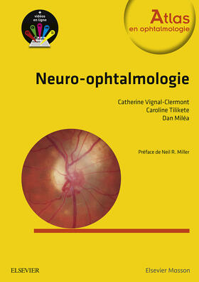 Miléa / Tilikete |  Neuro-ophtalmologie | eBook | Sack Fachmedien