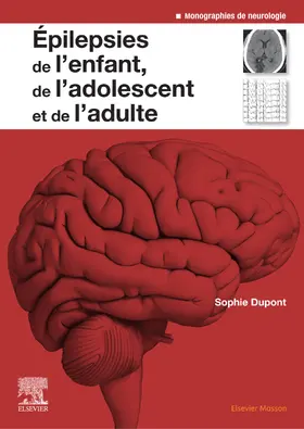 Dupont / Sadoux |  Epilepsies de l'enfant, de l'adolescent et de l'adulte | eBook | Sack Fachmedien