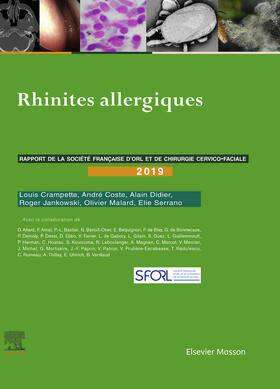 Coste / Crampette / Didier |  Rhinites allergiques | eBook | Sack Fachmedien