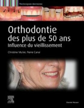 Canal / Muller |  Orthodontie des plus de 50 ans | eBook | Sack Fachmedien