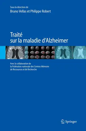 Vellas / Robert |  Traité sur la maladie d’Alzheimer | eBook | Sack Fachmedien