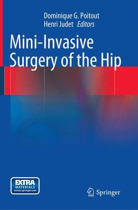 Judet / Poitout |  Mini-Invasive Surgery of the Hip | Buch |  Sack Fachmedien