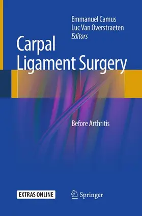 Van Overstraeten / Camus |  Carpal Ligament Surgery | Buch |  Sack Fachmedien