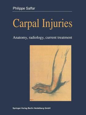 Saffar |  Carpal injuries | Buch |  Sack Fachmedien