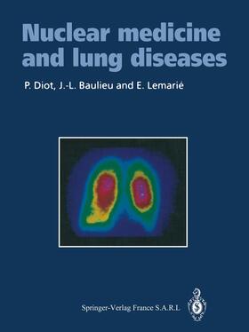 Diot / Baulieu / Lemarie |  Nuclear medicine and lung diseases | Buch |  Sack Fachmedien