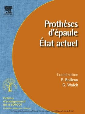 Boileau / Walch |  Prothèses d'épaule. État actuel | eBook | Sack Fachmedien