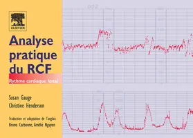 Gauge / Carbonne / Henderson |  Analyse pratique du RCF | eBook | Sack Fachmedien