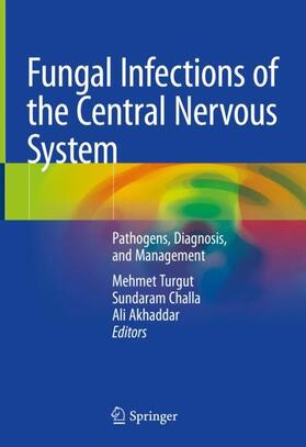 Turgut / Akhaddar / Challa |  Fungal Infections of the Central Nervous System | Buch |  Sack Fachmedien