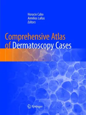 Lallas / Cabo |  Comprehensive Atlas of Dermatoscopy Cases | Buch |  Sack Fachmedien