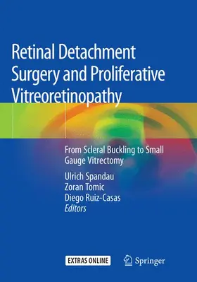 Spandau / Ruiz-Casas / Tomic |  Retinal Detachment Surgery and Proliferative Vitreoretinopathy | Buch |  Sack Fachmedien