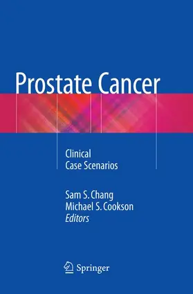 Cookson / Chang |  Prostate Cancer | Buch |  Sack Fachmedien