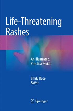 Rose |  Life-Threatening Rashes | Buch |  Sack Fachmedien