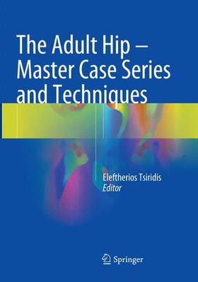 Tsiridis |  The Adult Hip - Master Case Series and Techniques | Buch |  Sack Fachmedien