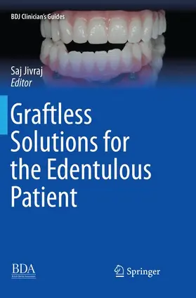 Jivraj |  Graftless Solutions for the Edentulous Patient | Buch |  Sack Fachmedien