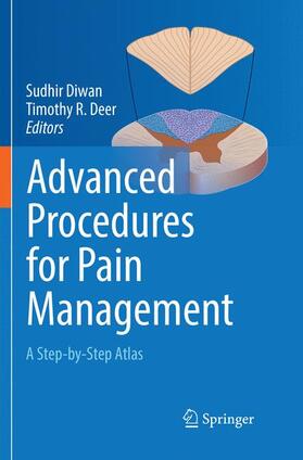 Deer / Diwan |  Advanced Procedures for Pain Management | Buch |  Sack Fachmedien