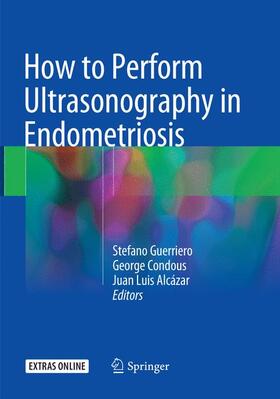Guerriero / Alcázar / Condous |  How to Perform Ultrasonography in Endometriosis | Buch |  Sack Fachmedien