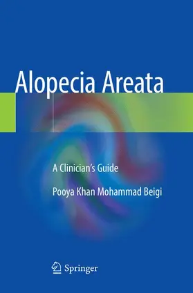 Khan Mohammad Beigi |  Alopecia Areata | Buch |  Sack Fachmedien