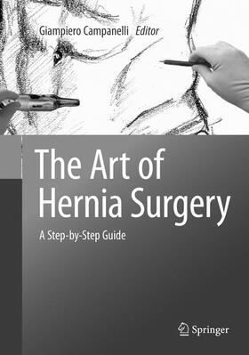 Campanelli |  The Art of Hernia Surgery | Buch |  Sack Fachmedien