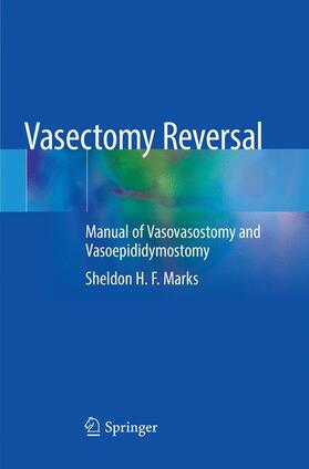 Marks |  Vasectomy Reversal | Buch |  Sack Fachmedien