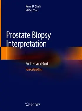 Zhou / Shah |  Prostate Biopsy Interpretation | Buch |  Sack Fachmedien