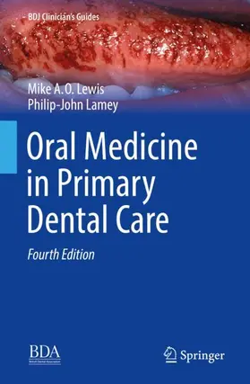 Lewis / Lamey |  Oral Medicine in Primary Dental Care | Buch |  Sack Fachmedien