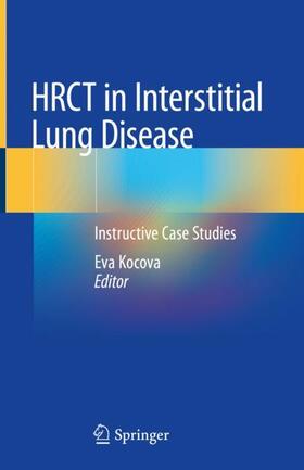 Kocova |  HRCT in Interstitial Lung Disease | Buch |  Sack Fachmedien