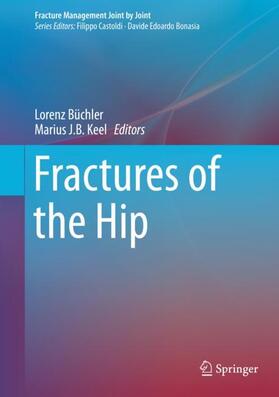 Keel / Büchler |  Fractures of the Hip | Buch |  Sack Fachmedien