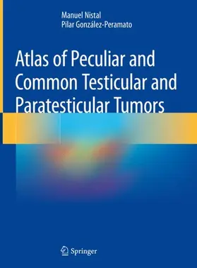 González-Peramato / Nistal |  Atlas of Peculiar and Common Testicular and Paratesticular Tumors | Buch |  Sack Fachmedien