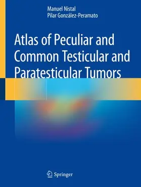 González-Peramato / Nistal |  Atlas of Peculiar and Common Testicular and Paratesticular Tumors | Buch |  Sack Fachmedien