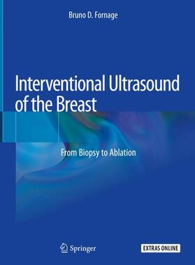 Fornage |  Interventional Ultrasound of the Breast | Buch |  Sack Fachmedien