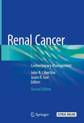 Gee / Libertino |  Renal Cancer | Buch |  Sack Fachmedien