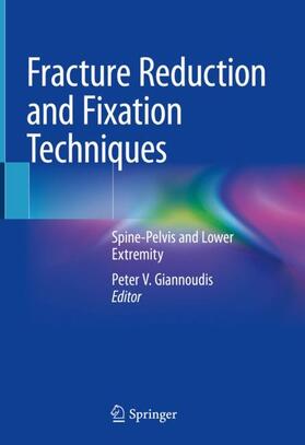 Giannoudis |  Fracture Reduction and Fixation Techniques | Buch |  Sack Fachmedien