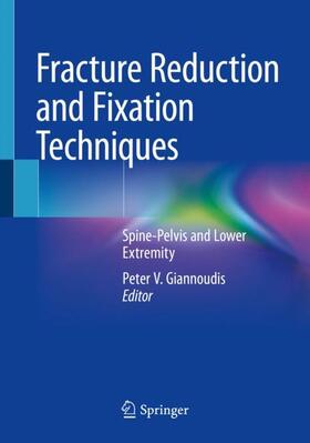 Giannoudis |  Fracture Reduction and Fixation Techniques | Buch |  Sack Fachmedien