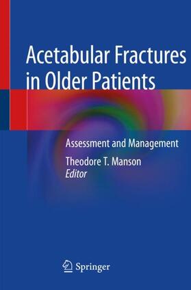 Manson |  Acetabular Fractures in Older Patients | Buch |  Sack Fachmedien