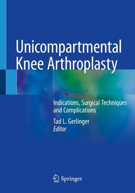 Gerlinger |  Unicompartmental Knee Arthroplasty | Buch |  Sack Fachmedien