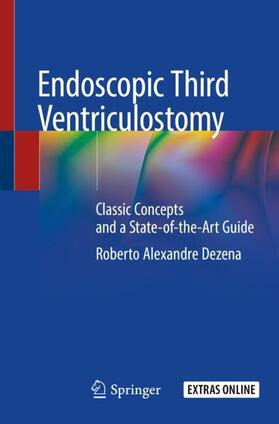 Dezena |  Endoscopic Third Ventriculostomy | Buch |  Sack Fachmedien
