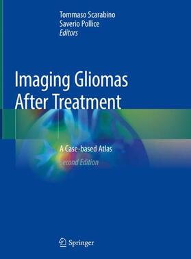 Scarabino / Pollice |  Imaging Gliomas After Treatment | Buch |  Sack Fachmedien