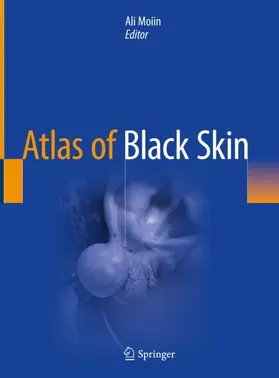 Moiin |  Atlas of Black Skin | Buch |  Sack Fachmedien