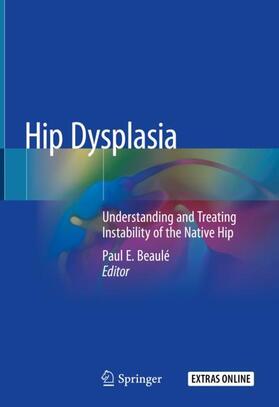 Beaulé |  Hip Dysplasia | Buch |  Sack Fachmedien