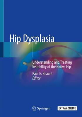 Beaulé |  Hip Dysplasia | Buch |  Sack Fachmedien