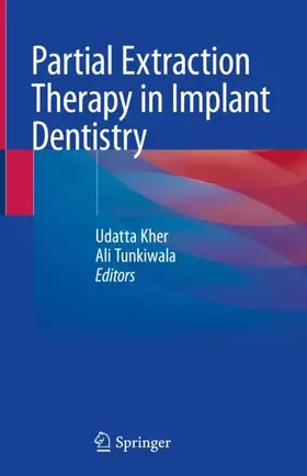 Tunkiwala / Kher |  Partial Extraction Therapy in Implant Dentistry | Buch |  Sack Fachmedien