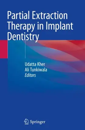 Tunkiwala / Kher |  Partial Extraction Therapy in Implant Dentistry | Buch |  Sack Fachmedien