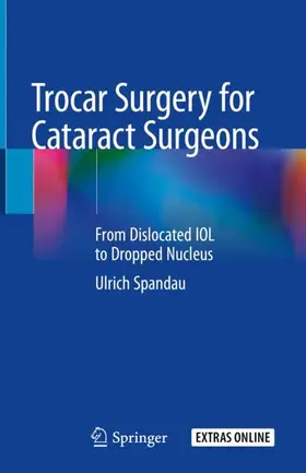 Spandau |  Trocar Surgery for Cataract Surgeons | Buch |  Sack Fachmedien