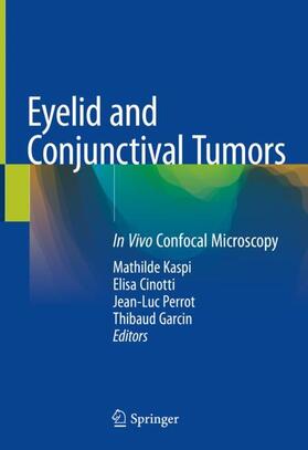 Kaspi / Garcin / Cinotti |  Eyelid and Conjunctival Tumors | Buch |  Sack Fachmedien